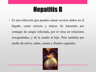 Hepatitis B
• Es una infección que pueden causar severos daños en el
hígado, como cirrosis y cáncer. Se transmite por
contagio de sangre infectada, por el virus en relaciones
sexogenitales, y de la madre al hijo. Pero también por
medio de saliva, sudor, semen y fluidos vaginales.
 