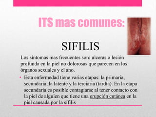 ITS mas comunes:
SIFILIS
Los síntomas mas frecuentes son: ulceras o lesión
profunda en la piel no dolorosas que parecen en los
órganos sexuales y el ano.
• Esta enfermedad tiene varias etapas: la primaria,
secundaria, la latente y la terciaria (tardía). En la etapa
secundaria es posible contagiarse al tener contacto con
la piel de alguien que tiene una erupción cutánea en la
piel causada por la sífilis
 