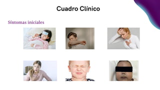 Cuadro Clínico
Síntomas iniciales
 