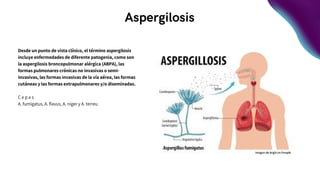 Aspergilosis
Desde un punto de vista clínico, el término aspergilosis
incluye enfermedades de diferente patogenia, como son
la aspergilosis broncopulmonar alérgica (ABPA), las
formas pulmonares crónicas no invasivas o semi-
invasivas, las formas invasivas de la vía aérea, las formas
cutáneas y las formas extrapulmonares y/o diseminadas.
C e p a s
A. fumigatus, A. flavus, A. niger y A. terreu
 