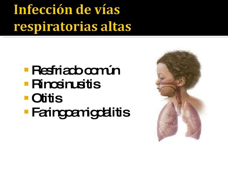 Infección De Vías Respiratorias Altas Pediatría www.slideshare.net