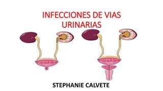 INFECCIONES DE VIAS
URINARIAS
STEPHANIE CALVETE
 