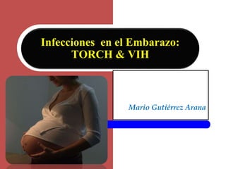Mario Gutiérrez Arana
Infecciones en el Embarazo:
TORCH & VIH
 