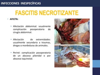 • AFECTA:
• Afectación abdominal: usualmente
complicación posoperatoria de
cirugía abdominal.
• Afectación de extremidades:
usualmente secundaria a traumas,
drogas o mordeduras de animales.
• Periné: complicación posoperatoria
de un absceso pilonidal o por
absceso isquirectal.
INFECCIONES INESPECÍFICAS
FASCITIS NECROTIZANTE
 