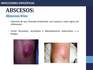 ABSCESOS:
Abscesosfríos
• Colección de pus, formada lentamente, con escasos o nulos signos de
inflamación.
• Tumor fluctuante, secundario a Mycobacterium tuberculosis y a
hongos.
INFECCIONES ESPECÍFICAS
 