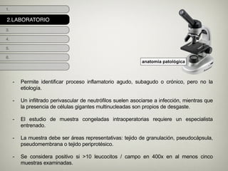 2.LABORATORIO
1.
3.
4.
5.
6.
anatomia patológica
- Permite identificar proceso inflamatorio agudo, subagudo o crónico, pero no la
etiología.
!
- Un infiltrado perivascular de neutrófilos suelen asociarse a infección, mientras que
la presencia de células gigantes multinucleadas son propios de desgaste.
!
- El estudio de muestra congeladas intraoperatorias requiere un especialista
entrenado.
!
- La muestra debe ser áreas representativas: tejido de granulación, pseudocápsula,
pseudomembrana o tejido periprotésico.
!
- Se considera positivo si >10 leucocitos / campo en 400x en al menos cinco
muestras examinadas.
 