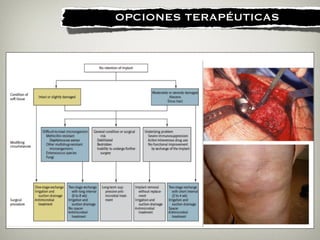 !
OPCIONES TERAPÉUTICAS
 