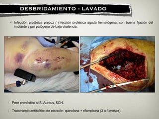 !
DESBRIDAMIENTO - LAVADO
- Infección protésica precoz / infección protésica aguda hematógena, con buena fijación del
implante y por patógeno de baja virulencia.
- Peor pronóstico si S. Aureus, SCN.
!
- Tratamiento antibiótico de elección: quinolona + rifampicina (3 a 6 meses).
 