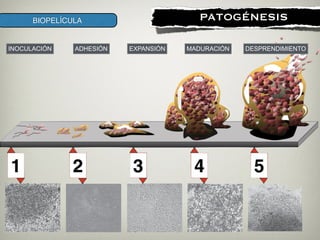 !
PATOGÉNESISBIOPELÍCULA
ADHESIÓN MADURACIÓNEXPANSIÓN DESPRENDIMIENTOINOCULACIÓN
 