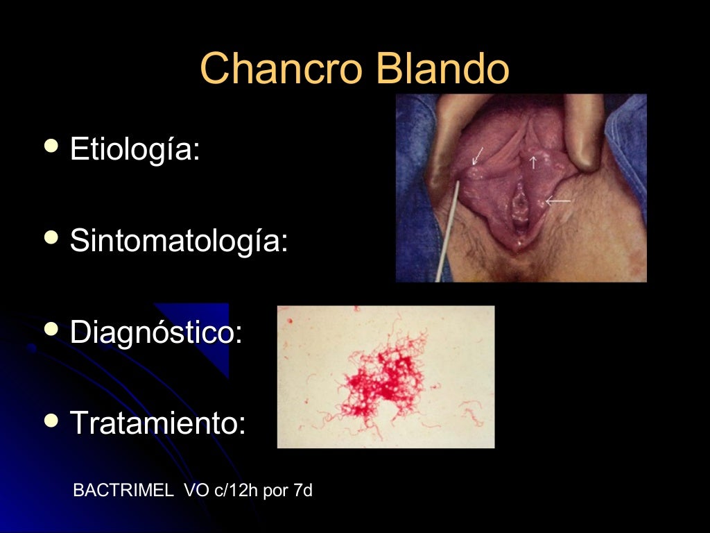 Porque Es Malo Soplar Los Genitales Infecciones genitales