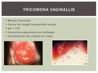  Menos frecuente
 Factor de riesgo transmisión sexual
 pH > 4.5
 Leucorrea espumosa con burbujas
 Visualización de colpitis en fresa
TRICOMONA VAGINALLIS
 