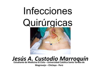 Infecciones
         Quirúrgicas


Jesús A. Custodio Marroquín
Estudiante de Medicina IX Ciclo – Universidad Católica Santo Toribio de
                    Mogrovejo – Chiclayo - Perú
 