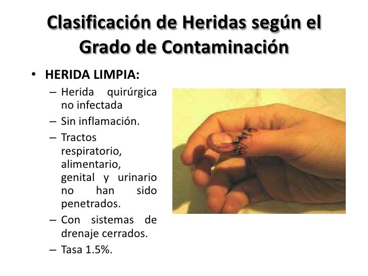 Infecciones Quirúrgicas