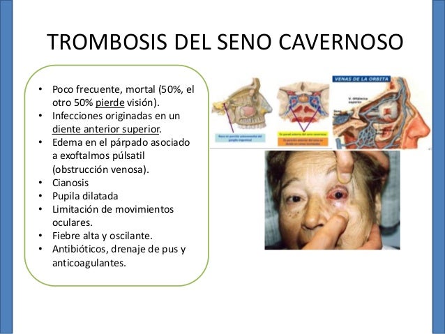 La clínica moderno flebologii ufa el sitio oficial