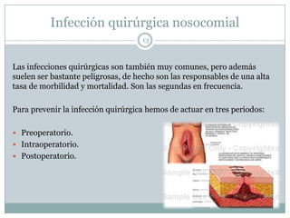 Infección quirúrgica nosocomial
13
Las infecciones quirúrgicas son también muy comunes, pero además
suelen ser bastante peligrosas, de hecho son las responsables de una alta
tasa de morbilidad y mortalidad. Son las segundas en frecuencia.
Para prevenir la infección quirúrgica hemos de actuar en tres periodos:
 Preoperatorio.
 Intraoperatorio.
 Postoperatorio.
 