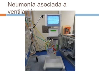 Neumonía asociada a
ventilación
 