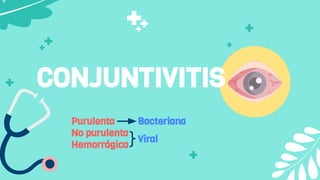 CONJUNTIVITIS
Purulenta
No purulenta
Hemorrágica
Bacteriana
Viral
 