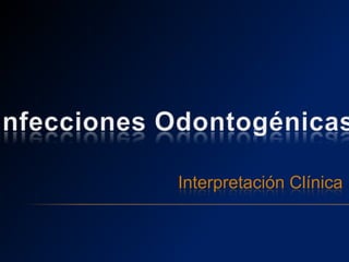 Infecciones Odontogénicas Interpretación Clínica 