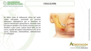 CELULITIS
Se define como la inflamación difusa del tejido
celular subcutáneo, ocasionada por procesos
infecciosos odontogénicos que se diseminan en
espacios intersticiales aponeuróticos, afectando tanto
los espacios aledaños a los dientes cercanos como los
distantes a ellos como: espacio bucal (60% de los
casos), seguido del espacio infraorbitario (13% de los
casos), maseterino, submandibular, submentoniano
y/o sublingual.
 