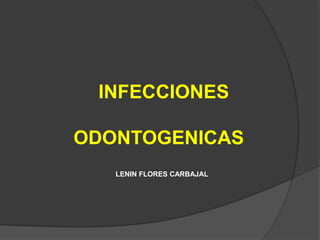 INFECCIONES
ODONTOGENICAS
LENIN FLORES CARBAJAL
 