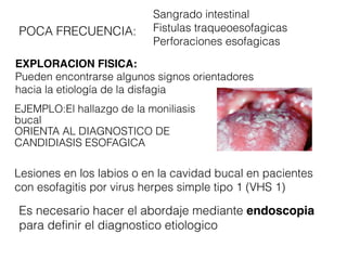 Sangrado intestinal
Fistulas traqueoesofagicas
Perforaciones esofagicas
EXPLORACION FISICA:
Pueden encontrarse algunos signos orientadores
hacia la etiología de la disfagia
POCA FRECUENCIA:
EJEMPLO:El hallazgo de la moniliasis
bucal
ORIENTA AL DIAGNOSTICO DE
CANDIDIASIS ESOFAGICA
Lesiones en los labios o en la cavidad bucal en pacientes
con esofagitis por virus herpes simple tipo 1 (VHS 1)
Es necesario hacer el abordaje mediante endoscopia
para definir el diagnostico etiologico
 