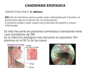 CANDIDIASIS ESOFAGICA
AGENTE ETIOLOGICO: C. albicans
20% De los individuos sanos pueden estar colonizados por Candida y al
presentarse alguna condición de inmunosupresion
la levadura puede invadir capas mas profundas del epitelio y causar
enfermedad
Es mas frecuente en pacientes sometidos a transplante renal
>son portadores de DM
Es la infección esofagica mas frecuente en pacientes VIH
positivos en el 50 % de los casos
 