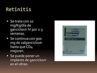 Retinitis
 Se trata con 10
mg/Kg/día de
ganciclovir IV por 2-3
semanas.
 Se continua con 900
mg de valganciclovir
hasta ...