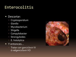 Enterocolitis
 Descartar:
 Cryptosporidium
 Giardia
 Mycobacterium
 Shigella
 Campylobacter
 Strongyloides
 E. his...