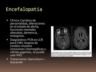 Encefalopatía
 Clínica: Cambios de
personalidad, alteraciones
en el estado de alerta,
funciones mentales
alteradas, demen...