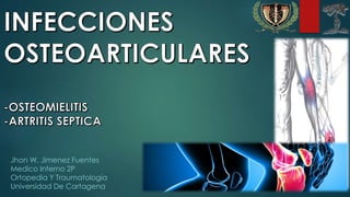 Jhon W. Jimenez Fuentes
Medico Interno 2P
Ortopedia Y Traumatología
Universidad De Cartagena
 