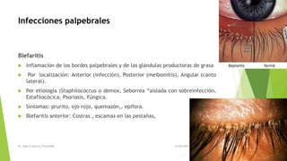 Infecciones palpebrales
Blefaritis
 Inflamación de los bordes palpebrales y de las glándulas productoras de grasa
 Por localización: Anterior (infección), Posterior (meibomitis), Angular (canto
lateral).
 Por etiología (Staphilococcus o demox, Seborrea “aislada con sobreinfección,
Estafilocócica, Psoriasis, Fúngica.
 Síntomas: prurito, ojo rojo, quemazón,, epifora.
 Blefaritis anterior: Costras , escamas en las pestañas,
Dr. Aldo G becerra Tirso R2MF 21/05/2016 1
 