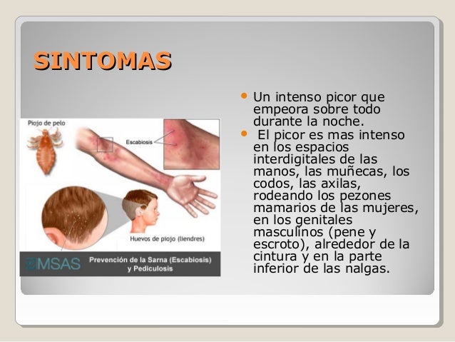 Infecciones parasitaria de la piel