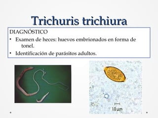 Trichuris trichiuraTrichuris trichiura
TRATAMIENTO
• Mebendazol: 100 mg vo cada 12 horas x 3 días ó 500 mg
vo en dosis úni...