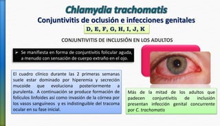 Conjuntivitis de oclusión e infecciones genitales
CONJUNTIVITIS DE INCLUSIÓN EN LOS ADULTOS
D, E, F, G, H, I, J, K
 Se manifiesta en forma de conjuntivitis folicular aguda,
a menudo con sensación de cuerpo extraño en el ojo.
El cuadro clínico durante las 2 primeras semanas
suele estar dominado por hiperemia y secreción
mucoide que evoluciona posteriormente a
purulenta. A continuación se produce formación de
folículos linfoides así como invasión de la córnea por
los vasos sanguíneos y es indistinguible del tracoma
ocular en su fase inicial.
Más de la mitad de los adultos que
padecen conjuntivitis de inclusión
presentan infección genital concurrente
por C. trachomatis
 