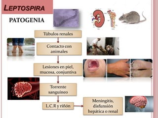 Infecciones por leptospira | PPTX
