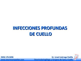 INFECCIONES PROFUNDAS
DE CUELLO

(669) 176.9498
www.otorrinomazatlan.com

Dr. Israel Lizárraga Padilla
Otorrinolaringólogo y Cirujano de Cara y Cuello

 