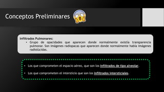 Conceptos Preliminares
Infiltrados Pulmonares:
• Grupo de opacidades que aparecen donde normalmente existía transparencia
pulmonar. Son imágenes radiopacas que aparecen donde normalmente había imágenes
radiolúcidas.
• Los que comprometen el espacio aéreo, que son los infiltrados de tipo alveolar.
• Los que comprometen el intersticio que son los infiltrados intersticiales.
 