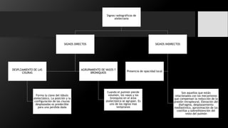 Signos radiográficos de
atelectasia
SIGNOS DIRECTOS
DESPLZAMIENTO DE LAS
CISURAS
Forma la clave del lóbulo
atelectásico. La posición y la
configuración de las cisuras
desplazadas es predecible
para una perdida dada
AGRUPAMIENTO DE VASOS Y
BRONIQUIOS
Cuando el pulmón pierde
volumen, los vasos y los
bronquios en el área
atelectásica se agrupan. Es
uno de los signos mas
tempranos
SIGNOS INDIRECTOS
Son aquellos que están
relacionados con los mecanismos
que compensan la reducción de la
presión intrapleural. Elevación del
diafragma, desplazamiento
mediastinico, aproximación de las
costillas y sobredistención del
resto del pulmón
Presencia de opacidad local
 