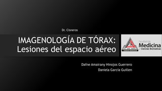 IMAGENOLOGÍA DE TÓRAX:
Lesiones del espacio aéreo
Dafne Amairany Hinojos Guerrero
Daniela García Guillen
Dr. Cisneros
 
