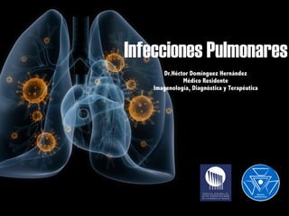 Infecciones Pulmonares
Dr.Héctor Domínguez Hernández
Médico Residente
Imagenología, Diagnóstica y Terapéutica
 