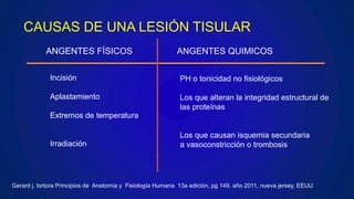 CAUSAS DE UNA LESIÓN TISULAR
ANGENTES FÍSICOS ANGENTES QUIMICOS
Incisión
Aplastamiento
Extremos de temperatura
Irradiación
PH o tonicidad no fisiológicos
Los que alteran la integridad estructural de
las proteínas
Los que causan isquemia secundaria
a vasoconstricción o trombosis
Gerard j. tortora Principios de Anatomía y Fisiología Humana 13a edición, pg 149, año 2011, nueva jersey, EEUU
 