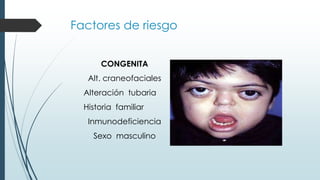 Factores de riesgo
CONGENITA
Alt. craneofaciales
Alteración tubaria
Historia familiar
Inmunodeficiencia
Sexo masculino
 