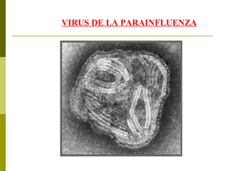VIRUS DE LA PARAINFLUENZA 