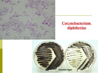 Corynebacterium  diphtheriae 