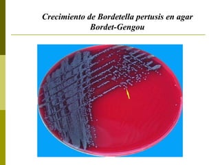 Crecimiento de Bordetella pertusis en agar Bordet-Gengou 