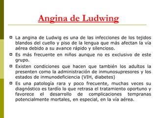 La angina de Ludwig es una de las infecciones de los tejidos blandos del cuello y piso de la lengua que más afectan la vía aérea debido a su avance rápido y silencioso.  Es más frecuente en niños aunque no es exclusivo de este grupo.  Existen condiciones que hacen que también los adultos la presenten como la administración de inmunosupresores y los estados de inmunodeficiencia (VIH, diabetes) Es una patología rara y poco frecuente, muchas veces su diagnóstico es tardío lo que retrasa el tratamiento oportuno y favorece el desarrollo de complicaciones tempranas potencialmente mortales, en especial, en la vía aérea.  Angina de Ludwing 