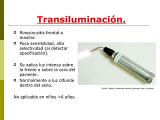 Transiluminación. Rinosinusitis frontal o maxilar. Poca sensibilidad, alta selectividad (al detectar opacificación). Se aplica luz intensa sobre la frente o sobre la cara del paciente. Normalmente a luz difunde dentro del seno. No aplicable en niños <6 años. © 2003 College of Veterinary Medicine, Michigan State  University 