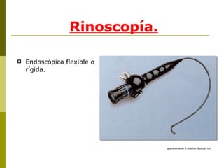 Rinoscopía. Endoscópica flexible o rígida. aparentemente ©  Kelleher Medical, Inc. 