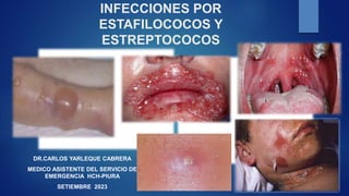 INFECCIONES POR
ESTAFILOCOCOS Y
ESTREPTOCOCOS
DR.CARLOS YARLEQUE CABRERA
MEDICO ASISTENTE DEL SERVICIO DE
EMERGENCIA HCH-PIURA
SETIEMBRE 2023
 