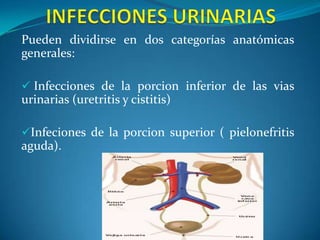 INFECCIONES URINARIAS  Pueden dividirse en dos categorías anatómicas generales: ,[object Object]
